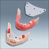 A-J OP UK Surgical Training Model - Single Arch