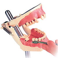 A-PB DA Periodontal Typodont