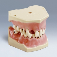 A-PB Periodontal Typodont
