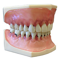 A-PZ KR Periodontal Typodont