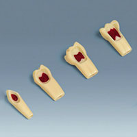 AK-6/2 ZPUW Pulpotomy Tooth with Red Wax Insert

