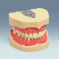 ANA-4V Advanced Standard Typodont